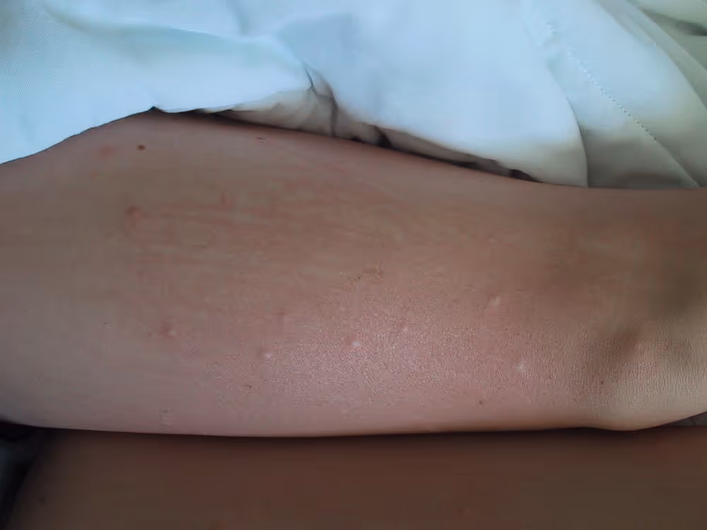 Boutons de puces de parquet